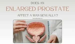 Does An Enlarged Prostate Affect A Man Sexually